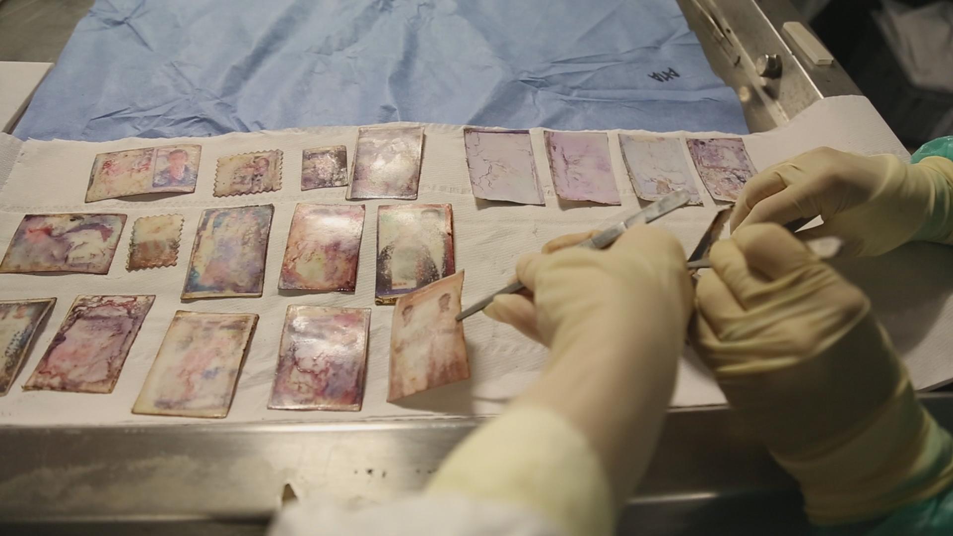 Still from Number 387. Three gloved hands are examining photos on a medical table.